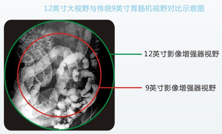 全数字胃肠机