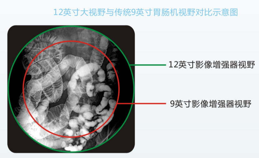 平板数字胃肠机