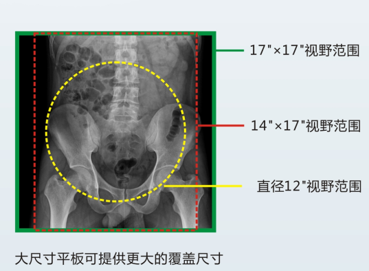 多功能动态DR