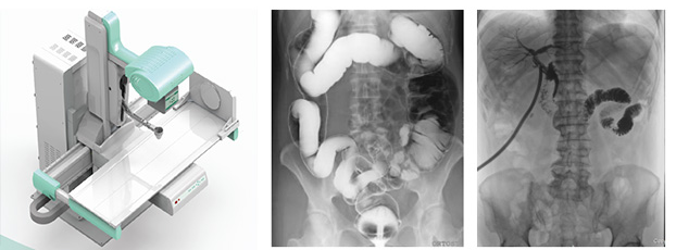 x线数字胃肠机