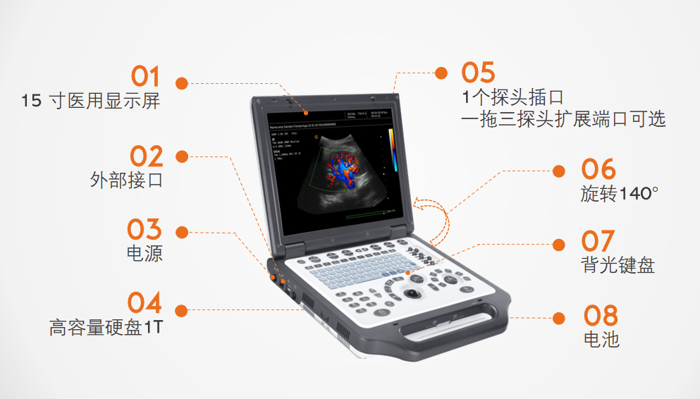 便携式彩超设备