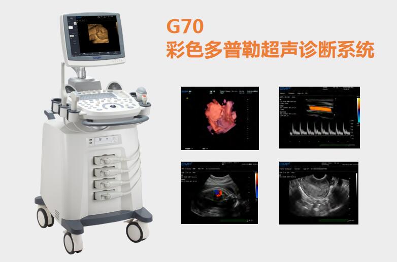 多普勒超声成像系统